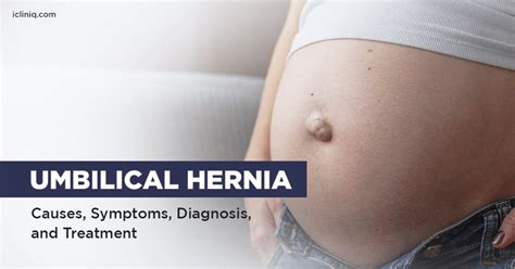 What Is Umbilical Hernia?