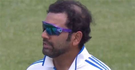 Rohit Sharma Hair Fall: Has Indian Captain Had A Hair Transplant? - The SportsRush