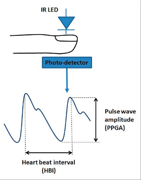 Photoplethysmography and photopletysmographic waveform. An Infrared LED ...