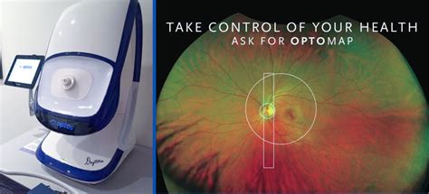 OPTOMAP Retinal Scan – Waltham Abbey Opticians | Professional Eye Tests ...