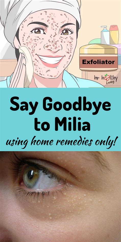 Say goodbye to Milia using home remedies only! | Pimples on face, Home remedies, Diy exfoliating ...