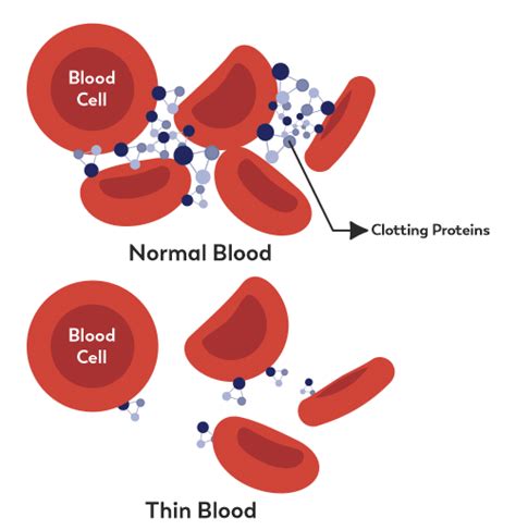 How Much Does Alcohol Thin Your Blood? - Recovery Ranger