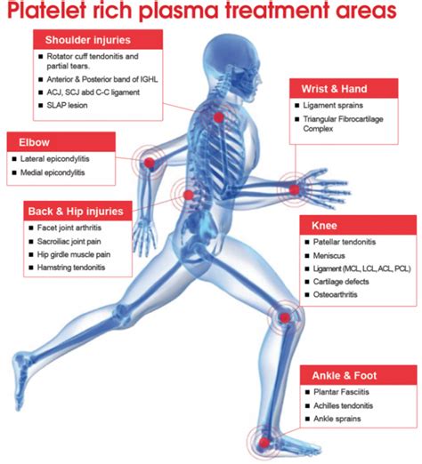 Knee PRP Injections Phoenix Medicine