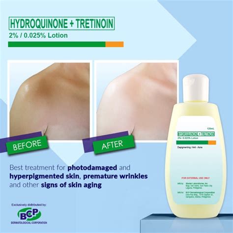 Hydroquinone LOTION 2% Skin Whitening 60mL -Trial pack | Shopee Philippines