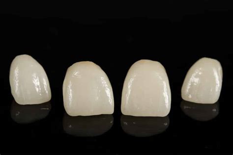 Dental Crowns of Different Sizes | Maple Grove, MN