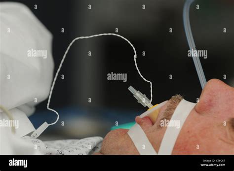 TRACHEAL INTUBATION Stock Photo: 49313848 - Alamy