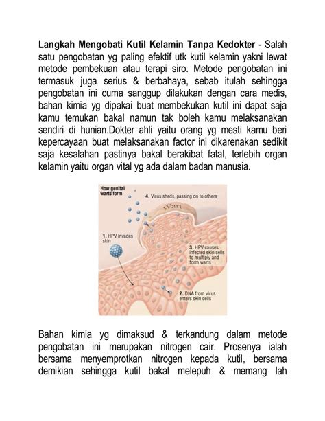 Langkah Mengobati Kutil Kelamin Tanpa Kedokter