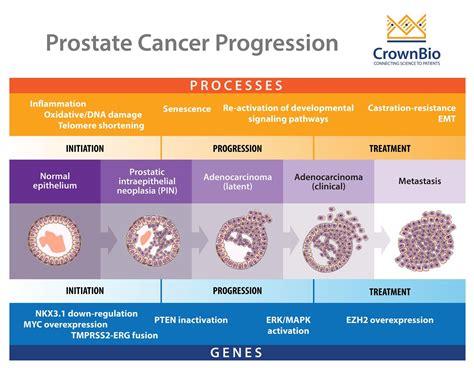 Why Are Prostate Cancer Preclinical Models Hard to Develop?