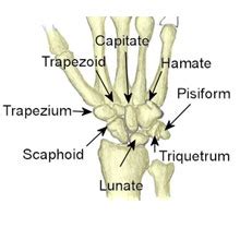 Carpal Fracture|Sprained wrist symptoms, causes and treatment ...