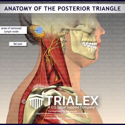 Anatomy of the Posterior Triangle - TrialExhibits Inc.