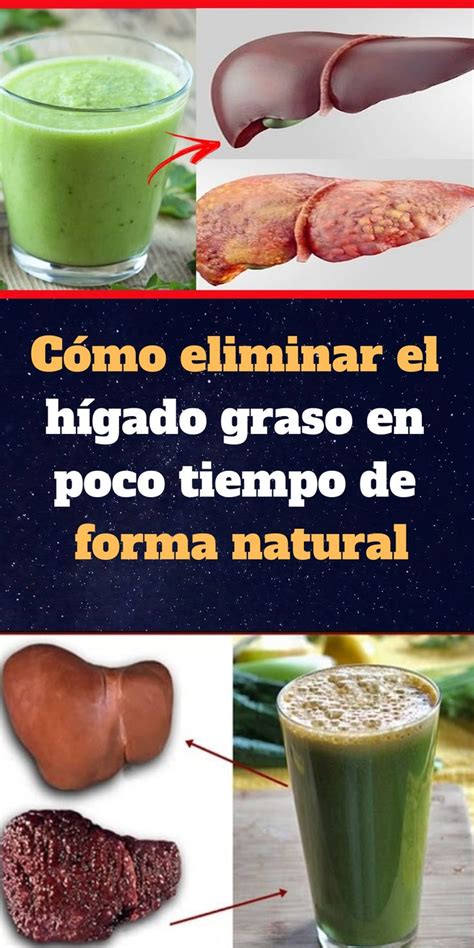 Cómo eliminar el hígado graso en poco tiempo de forma natural | Dolor de higado, Dieta para ...