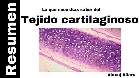 Tejido cartilaginoso (resumen) (Histología De Ross 7a Edición) - YouTube