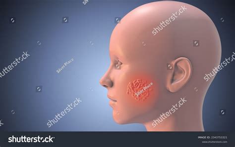 155 Face Spider Veins Images, Stock Photos & Vectors | Shutterstock