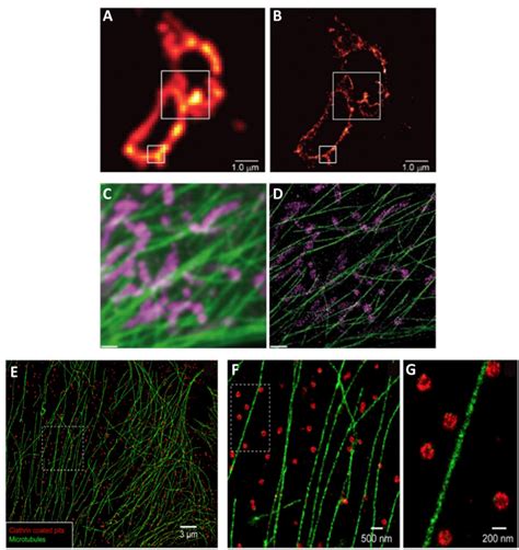 Super resolution microscopy | Possibility | Teledyne Imaging