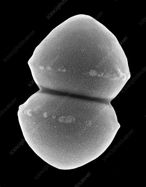 Enterococcus faecium, SEM - Stock Image - C037/0114 - Science Photo Library