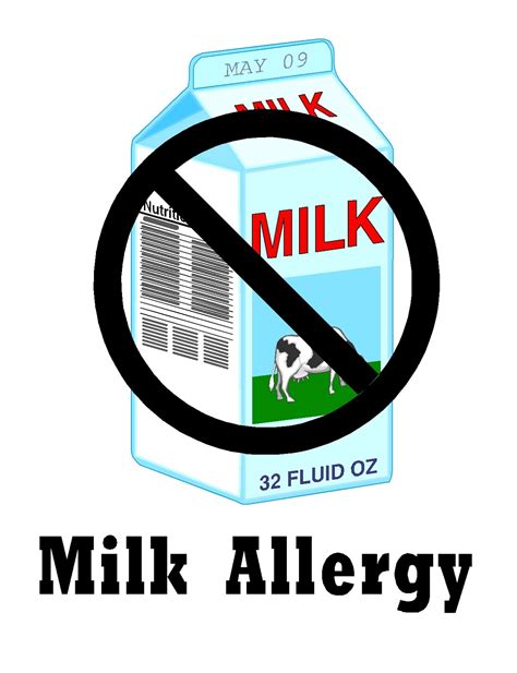 Free Posters and Signs: Milk Allergy