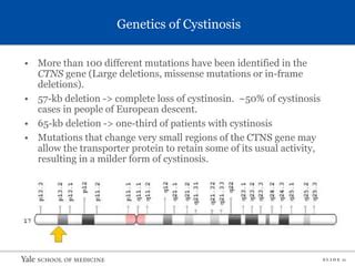 Cystinosis.pptx