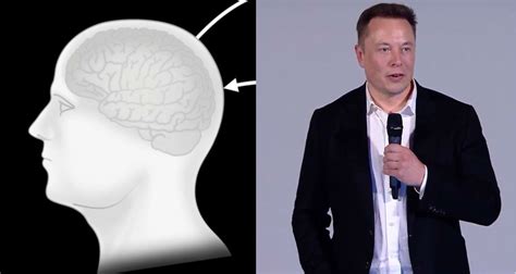 LIVESTREAM: Watch Elon Musk detail Neuralink's brain interface developments