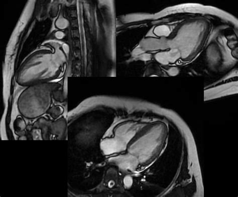 Chụp MRI tim phương pháp quan trọng như thế nào đối với sức khoẻ? - BlogAnChoi