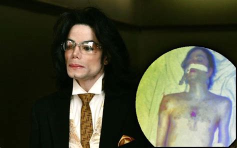 Michael Jackson Real Autopsy Photos