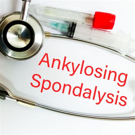 Pfizer's Xeljanz approved for ankylosing spondylitis | Seeking Alpha