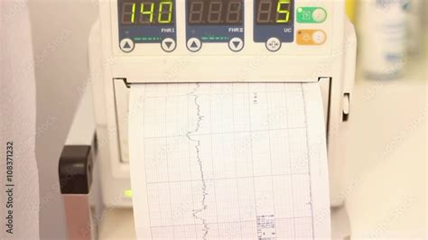 Fetal heartbeat monitor, cardiotocography Stock Video | Adobe Stock