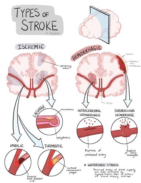 Top 10 neurología ideas and inspiration