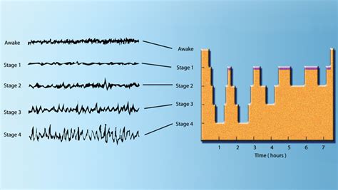 Stages of sleep eeg - usevsera