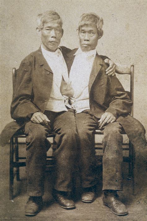 Chang and Eng Bunker, the ‘definitive’ Siamese twins, 1865. [2048×1363]