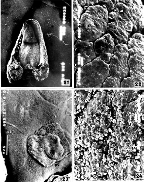 Figure 21 from The fine structure of the dorsal lingual epithelium of the scincine lizard ...