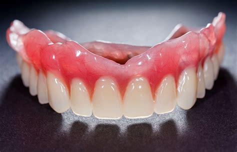 What is denture adhesive and do I need it? - from 123Dentist