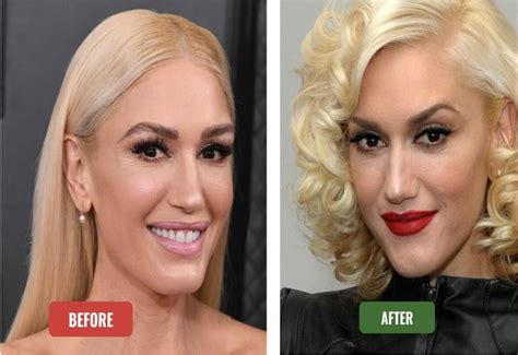 Gwen Stefani New Look (Plastic Surgery): What's the Secret?