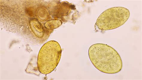 Pinworms Life Cycle | Sciencing