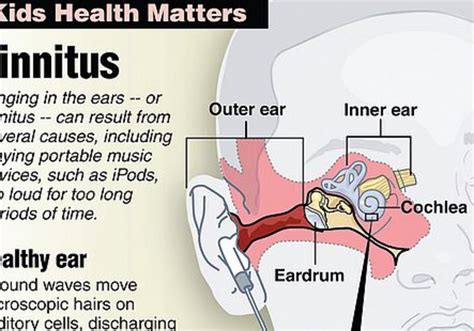 Health: Stop the ringing! - Magazine - Jerusalem Post