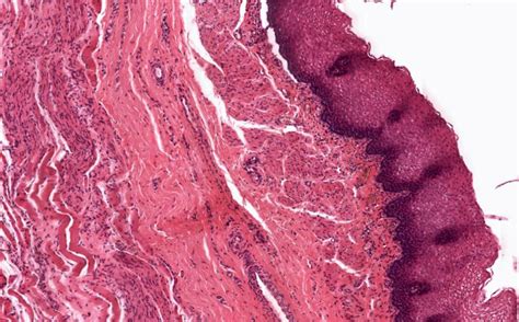 Esophageal Sphincter Histology