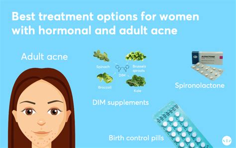 Hormonal acne: Best treatment according to Dermatologists | MDacne