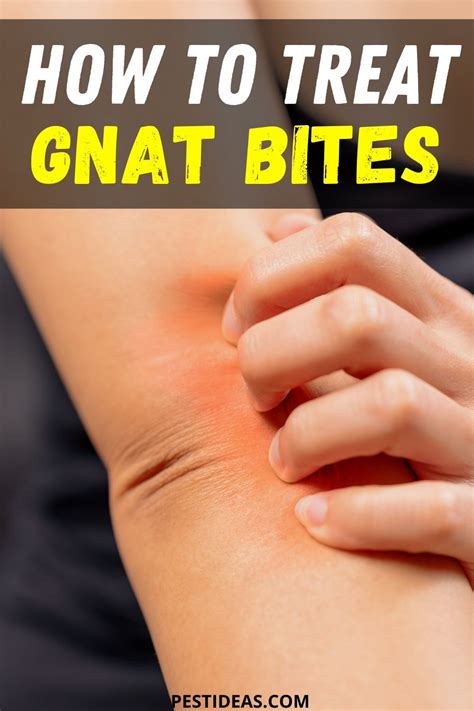 How to Treat Gnat Bites in 2020 | Gnat bites, How to get rid of gnats, Gnats