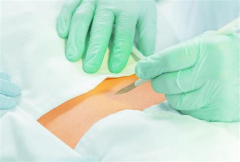 Incision And Drainage Trays – Welcome To Busse Hospital, 59% OFF