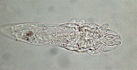 File:Demodex-whole-mite.jpg - Wikimedia Commons