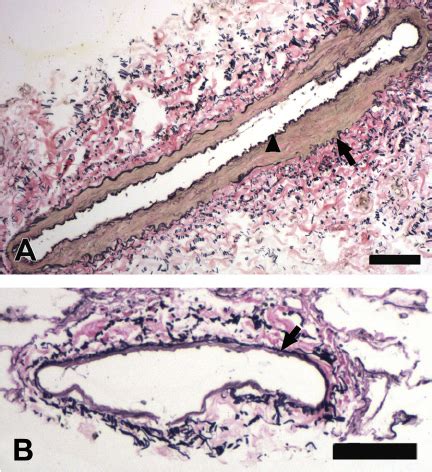 Pulmonary Artery Histology