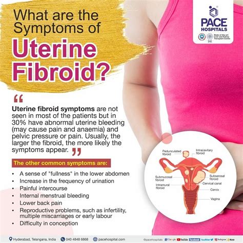 Uterine Fibroids - Symptoms, Causes, Complications and Prevention