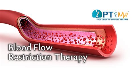 Blood Flow Restriction Therapy - PT & ME