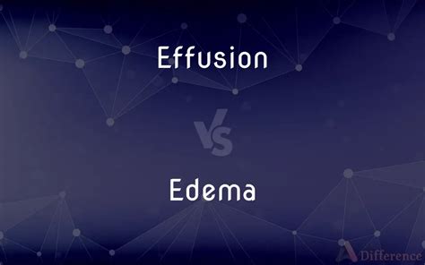 Effusion vs. Edema — What’s the Difference?