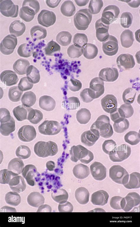 Platelets microscope hi-res stock photography and images - Alamy