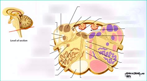 Medulla, level of the inferior olive Diagram | Quizlet