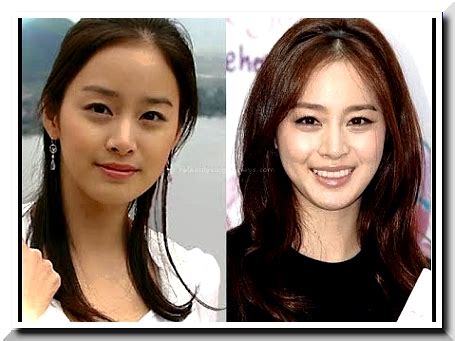 Kim Tae Hee Plastic Surgery Rumors – Was It Really A Fake Beauty ...