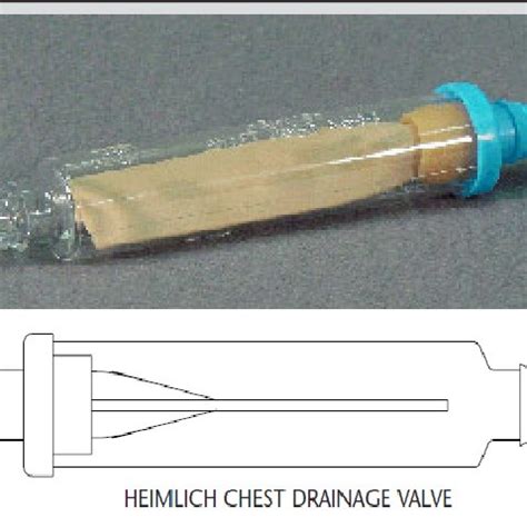 (PDF) The Heimlich Valve for Pleural Cavity Drainage