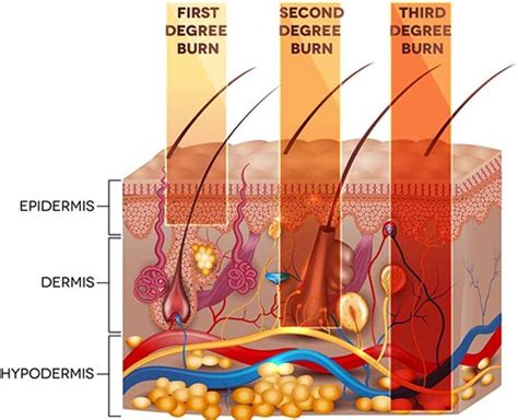 Sun Damaged Skin Treatments NYC | Manhattan Dermatology Specialists