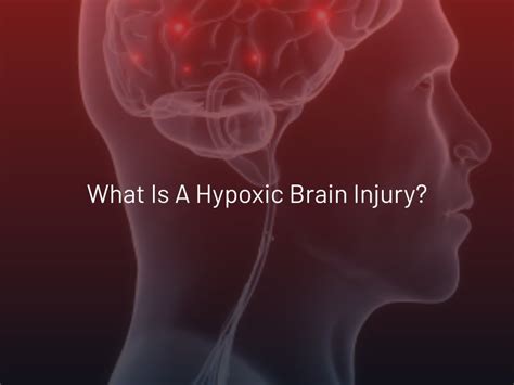 What Is An Anoxic Brain Injury? Definition And Symptoms, 53% OFF