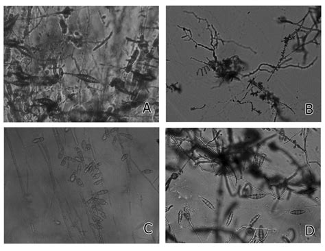 Macroconidia of (A); Spiral hyphae and microconidia of (B); Microsporum... | Download Scientific ...